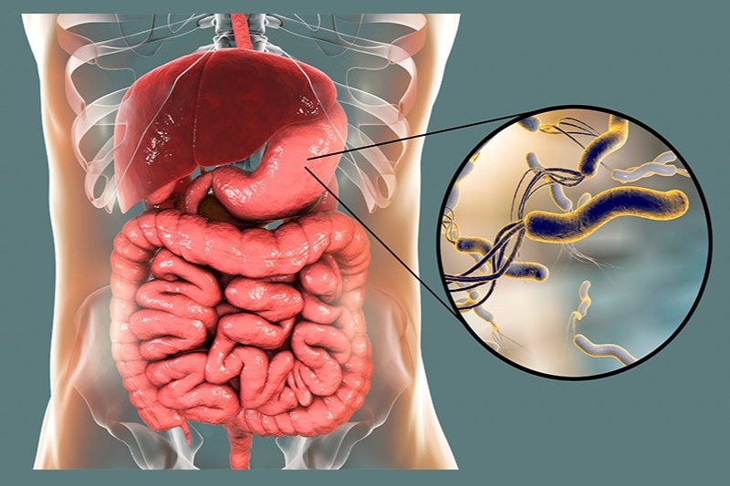 Imagem ilustrativa do habitat natural da bactéria Helicobacter pylori: nosso estômago. Créditos: iGastroProcto