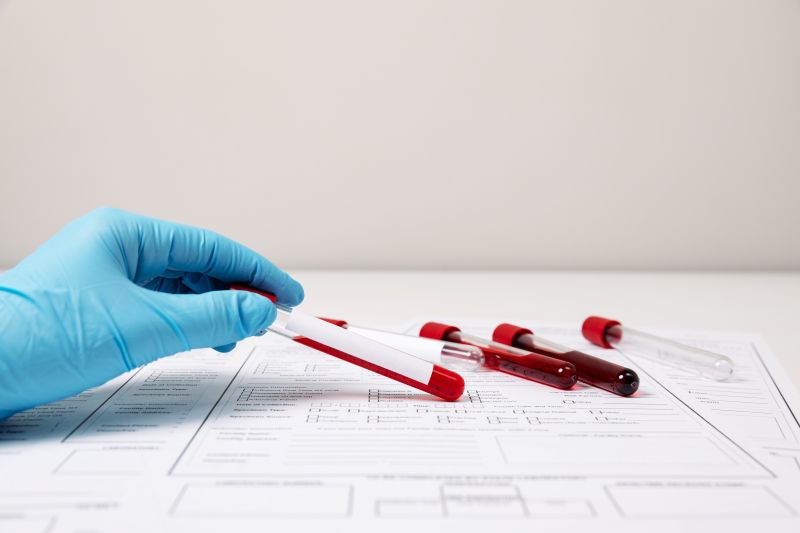 Exames de sangue diagnosticam o potássio alto e outras doenças.